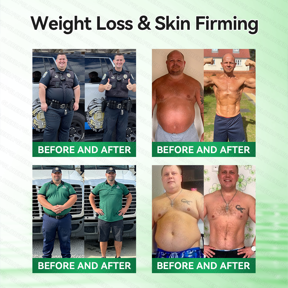 🇨🇦𝑶𝒇𝒇𝒊𝒄𝒊𝒂𝒍 𝑺𝒕𝒐𝒓𝒆  | 🍎𝐆𝑳𝑶𝗥𝗘𝗡𝘿𝘼® 𝙈𝒐𝒓𝒊𝒏𝒈𝗮 · 𝗕𝗲𝗿𝗯𝐞𝐫𝐢𝐧𝙚 × 𝙉𝑨𝑫+ 𝟏𝟎-𝙞𝙣-𝟏 𝘼𝒅𝒗𝒂𝒏𝒄𝒆𝐝 𝐍𝐚𝐧𝙤 𝙈𝙞𝙘𝙧𝙤𝙣𝒆𝒆𝒅𝒍𝐞 𝐏𝐚𝐭𝙘𝙝(𝐉𝐮𝐬𝐭 𝐨𝐧𝐜𝐞 𝐚 𝐝𝐚𝐲, 𝐯𝐢𝐬𝐢𝐛𝐥𝐞 𝐜𝐡𝐚𝐧𝐠𝐞𝐬 𝐢𝐧 𝟕 𝐝𝐚𝐲𝐬） ✅ 𝐅𝐨𝐫 𝐨𝐛𝐞𝐬𝐢𝐭𝐲,𝐝𝐢𝐚𝐛𝐞𝐭𝐞𝐬, 𝐬𝐥𝐞𝐞𝐩 𝐚𝐩𝐧𝐞𝐚, 𝐣𝐨𝐢𝐧𝐭 𝐢𝐬𝐬𝐮𝐞𝐬, 𝐚𝐧𝐝 𝐦𝐨𝐫𝐞